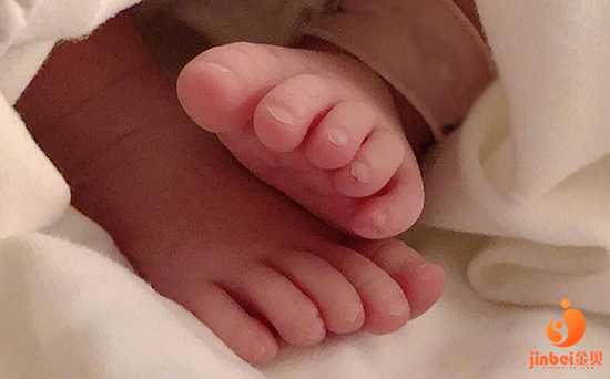 广西借卵包男孩,【广州供卵机构包男孩】31周顺产女宝宝