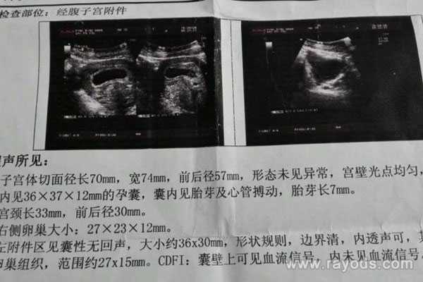宁波哪里需要代孕的,宁波新生儿医保办理需要哪些证件